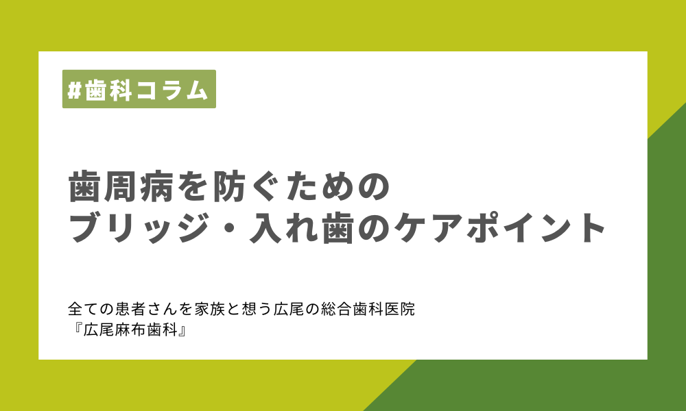 歯周病を防ぐためのブリッジ・入れ歯のケアポイント