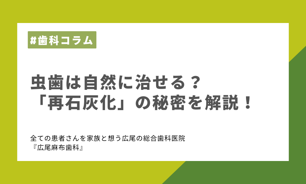 虫歯は自然に治せる?「再石灰化」の秘密を解説!